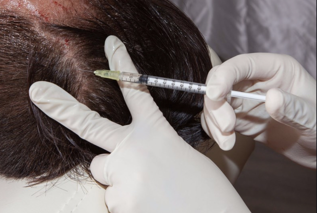Scalp / Hair Problems | Faciem Dermatology Clinic