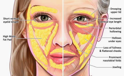 Ageing of the Face