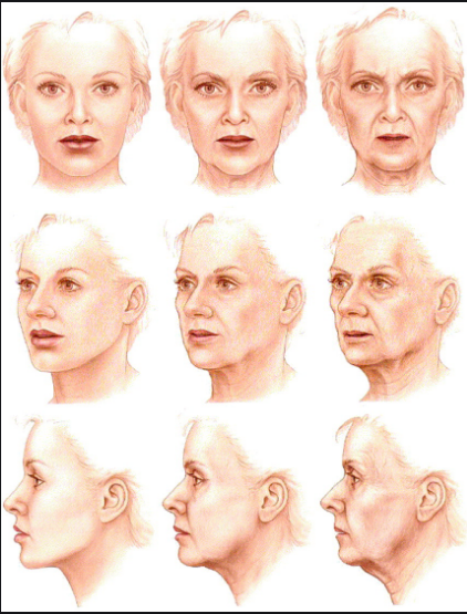 Ageing of the Face