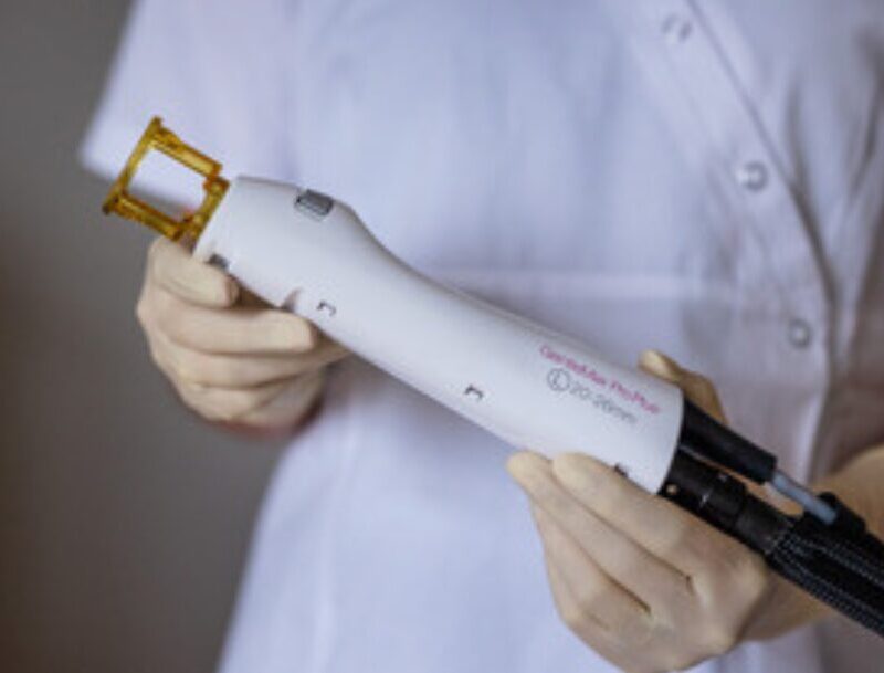 Faciem Blog Feature Images Candela Gentle Max Pro Plus